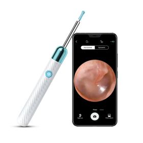 ClearView™ - HD Ear Inspection Tool (Option: White With 4 Ear Pick Sets)